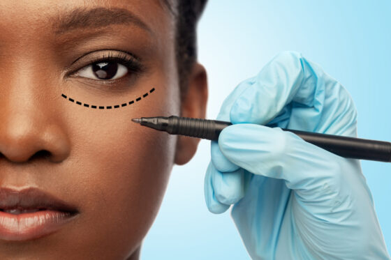 Top 5 Mistakes with Selecting Facelift Surgeons and How to Avoid Them