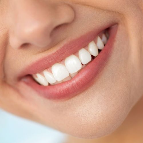 5 Dangers of At-Home Teeth Whitening Treatments